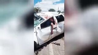 Man Driver Lost His Brain In A Car Accident