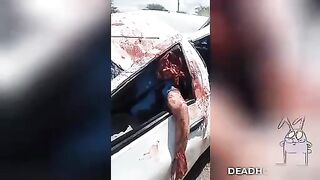 Man Driver Lost His Brain In A Car Accident