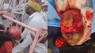 Young Woman Scalped Following Ferris Wheel Accident (More Footage)