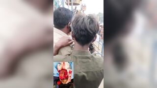 Young Woman Scalped Following Ferris Wheel Accident (More Footage)