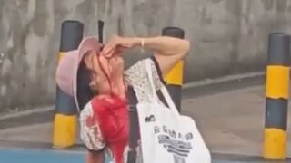 Woman Stabbed In The Eye In Random Attack In China