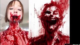 HolyShit: Multiples Incised Wounds To The Neck. Sick Video