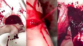 HolyShit: Multiples Incised Wounds To The Neck. Sick Video