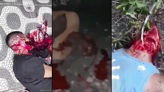 HolyShit: Multiples Incised Wounds To The Neck. Sick Video