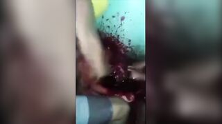 HolyShit: Multiples Incised Wounds To The Neck. Sick Video