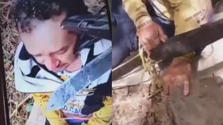 Kidnapped For Ransom Man Gets  Fingers Cut Off With Machete