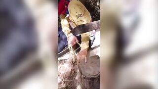 Kidnapped For Ransom Man Gets  Fingers Cut Off With Machete