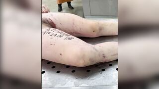 19 year old dead woman at morgue