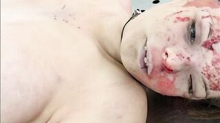 19 year old dead woman at morgue