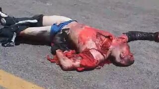 Motorcyclist Killed By Hit And Run Driver