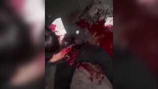 Man Attacked With Machete Over A Debt