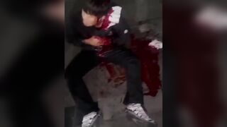 Man Attacked With Machete Over A Debt