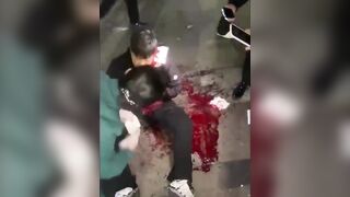 Man Attacked With Machete Over A Debt