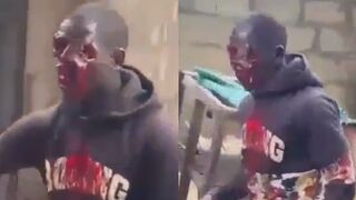 Protester Shot In The Face By Police in Nigeria