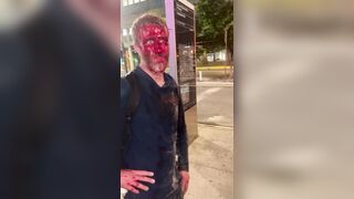 Dude Attacked With Brass Knuckles In New York