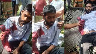 Arm severed in traffic accident