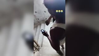 Sicko Tries To Sell A Human Arm