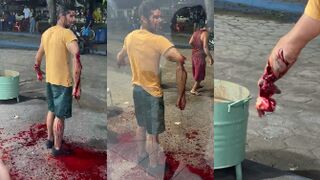 That Blood Loss Will Kill Him In A Minute