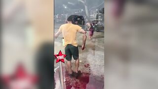 That Blood Loss Will Kill Him In A Minute