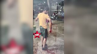 That Blood Loss Will Kill Him In A Minute