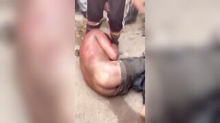 Man Who Killed His 3-Year-Old Son Attacked By Mob In Venezuela