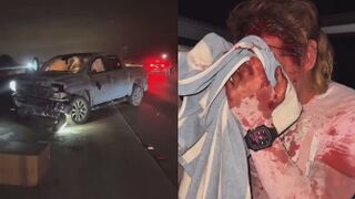 USA: Transgender Wearing Diapers Totals His Truck In Los Angeles