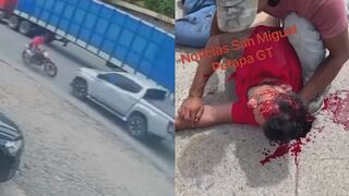 Helmetless Biker Seriously Injured In Head On Collision