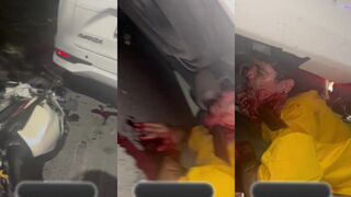 Holy shit, he's got an exhaust pipe running through his neck.