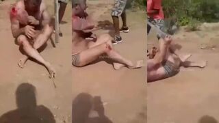 CLASSIC A White Farmer was attacked by a Black Attacker in South Africa