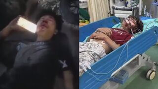 Two Mopeds Collide Leaving One Dead And One In Coma