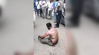 Man Attempted Self Immolation After GF Rejected Him
