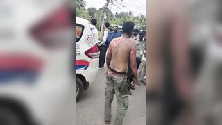 Man Attempted Self Immolation After GF Rejected Him