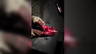A Russian serviceman had both feet blown off