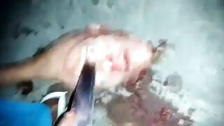CLASSIC: Eyes Popped Out With Knife
