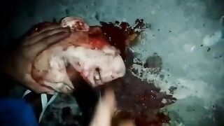 CLASSIC: Eyes Popped Out With Knife