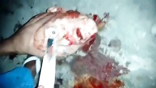 CLASSIC: Eyes Popped Out With Knife