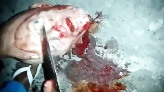 CLASSIC: Eyes Popped Out With Knife