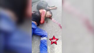 Poor Guy Needs A Helping HAND, Right Now