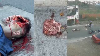 Mind-blowing Accident, LITERALLY