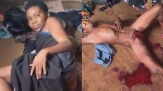 Man Castrated By GF After Confrontation (FULL)
