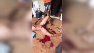 Man Castrated By GF After Confrontation (FULL)