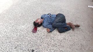 Cable Thief Slowly Dies After Leaving His Palm On Copper Cable