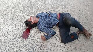 Cable Thief Slowly Dies After Leaving His Palm On Copper Cable
