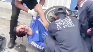 Motorcyclist dies after losing control, hitting wall in Venezuela