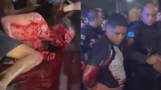 Result Of Police Operation In Northern Zone of Rio de Janeiro (CLEAN VIDEO)