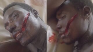 Farmer Left Wounded by Machete-Wielding Soldiers Seizing Harvest
