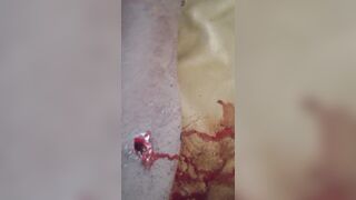 Farmer Left Wounded by Machete-Wielding Soldiers Seizing Harvest