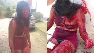 Driven by Jealousy Man Attacked His GF With A Broken Bottle