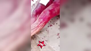 Driven by Jealousy Man Attacked His GF With A Broken Bottle