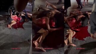 (REPOST)wounded criminal clings to life
